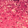 Vet News – Interesting Research micrograph of prion affected neural tissue