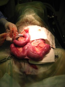 Pyometra, infected uterus, surgery